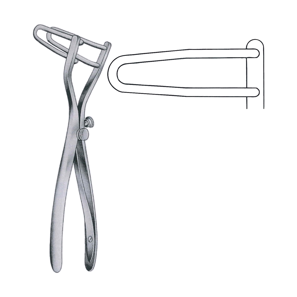 Schulze-Bergmann Intestinal Rectal Speculum 22 cm, 8 3/4", 20 x 65 mm (MB12-092)