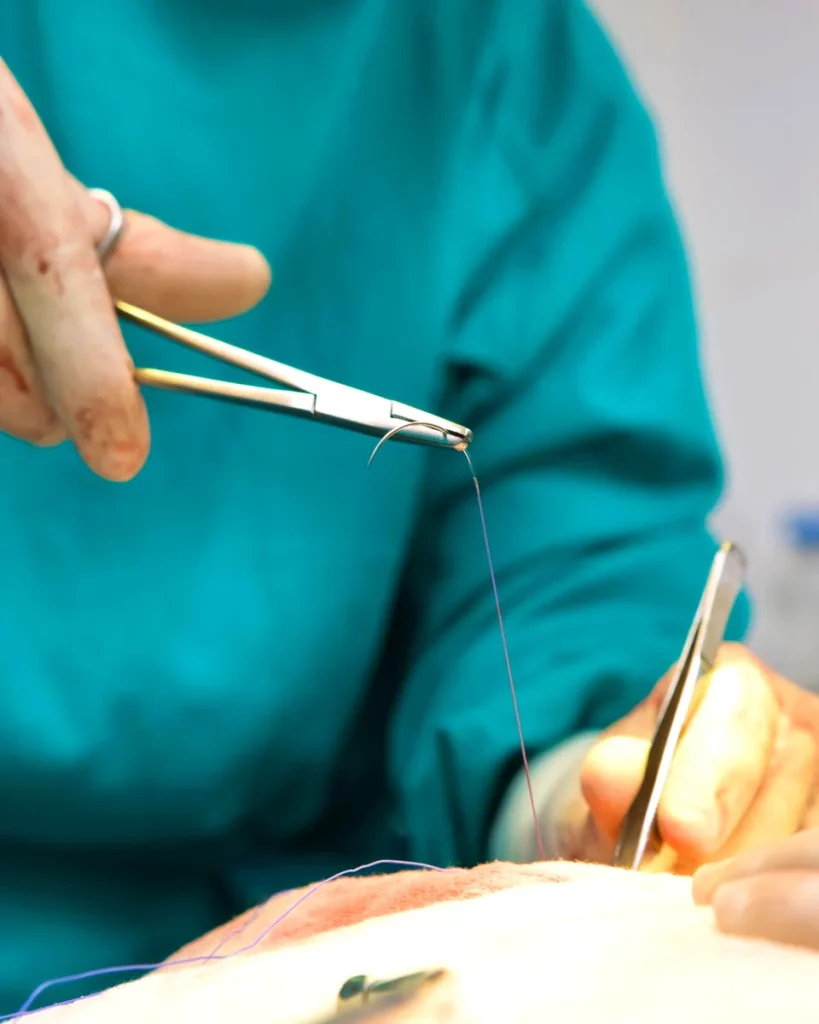 Needle Holders